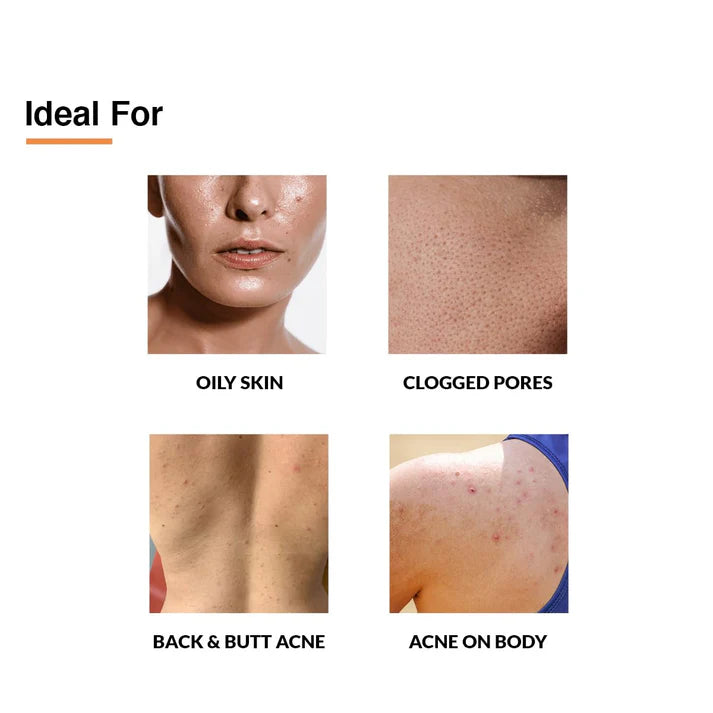 Salyzap Body Spray | 50ml